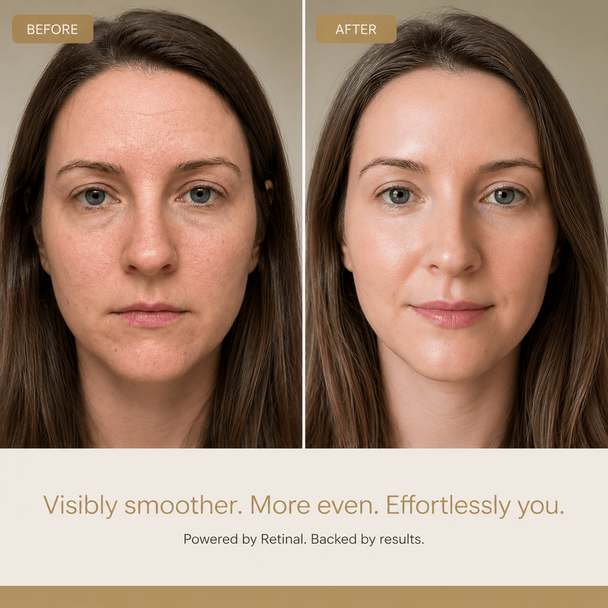 Soléira Retinal Cream