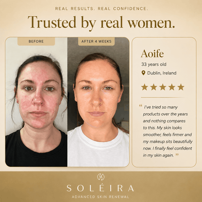 Soléira Retinal Cream