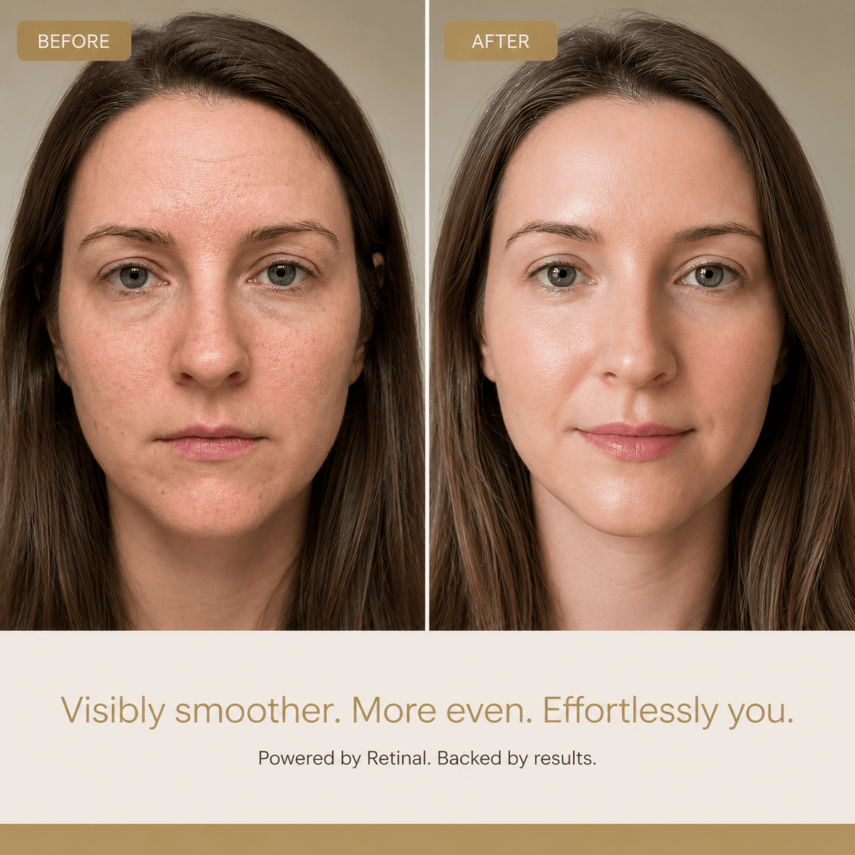 Soléira Retinal Cream