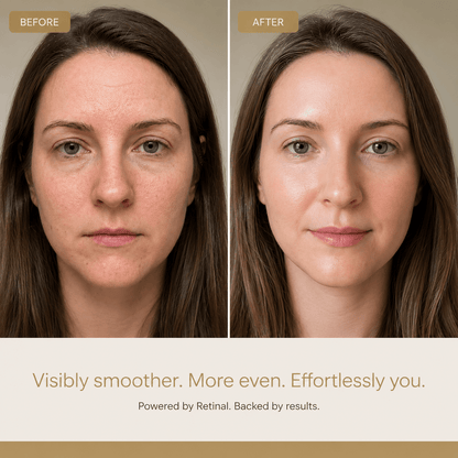 Soléira Retinal Cream