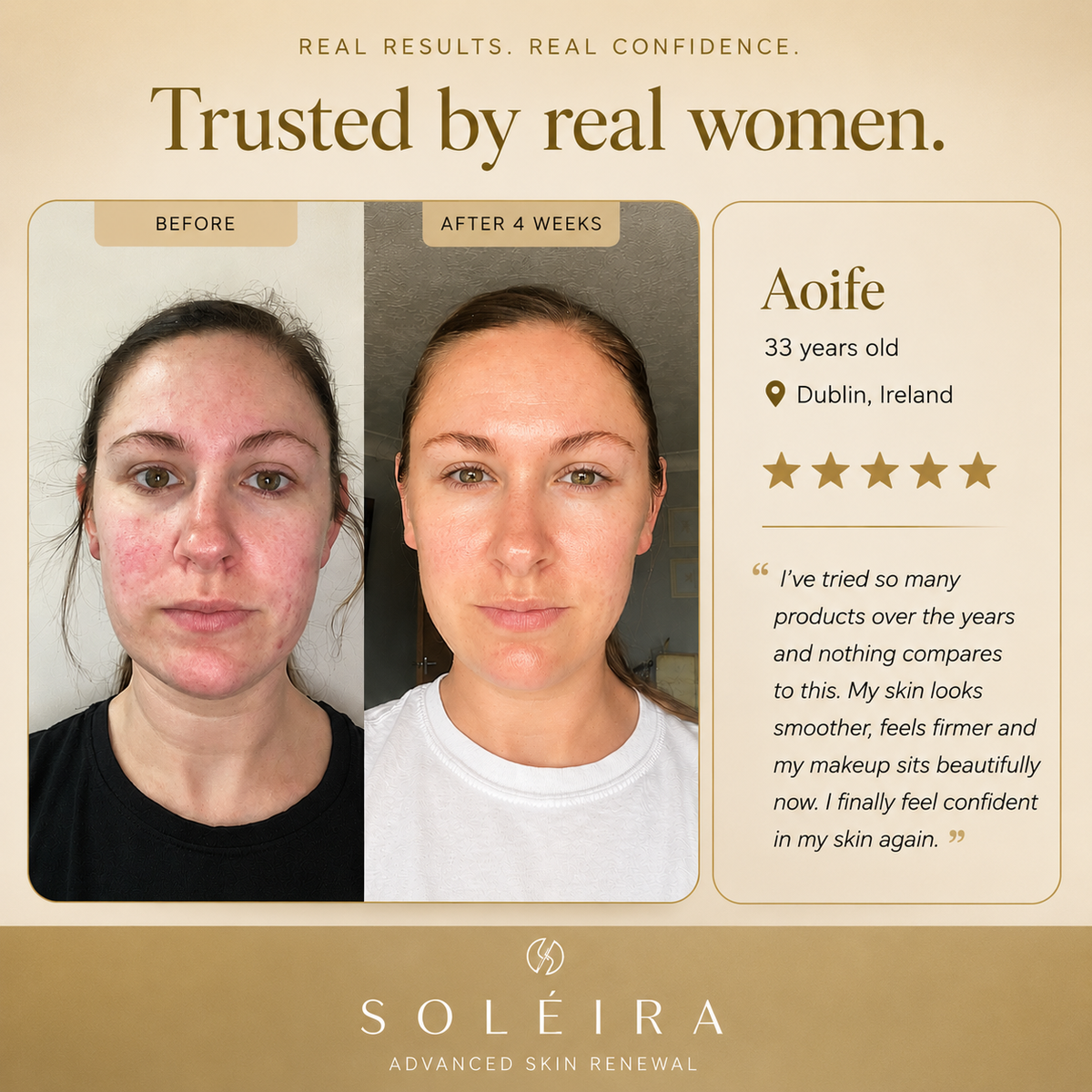 Soléira Retinal Cream