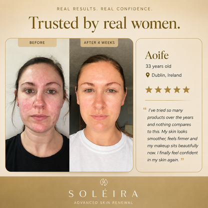 Soléira Retinal Cream